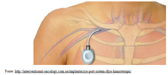 questões de concursos Universidade Federal do Mato Grosso (UFMT) 2018 